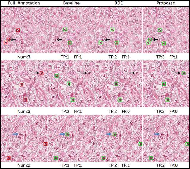 Figure 1 for Positive-unlabeled learning for binary and multi-class cell detection in histopathology images with incomplete annotations