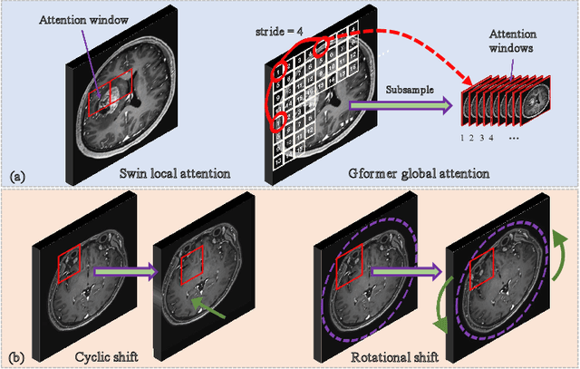 Figure 3 for Simulation of Arbitrary Level Contrast Dose in MRI Using an Iterative Global Transformer Model