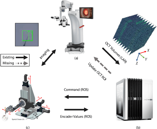 Figure 1 for Robotic Navigation Autonomy for Subretinal Injection via Intelligent Real-Time Virtual iOCT Volume Slicing
