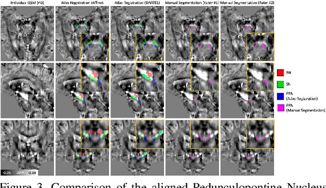 Figure 4 for Implicit Neural Representation in Medical Imaging: A Comparative Survey