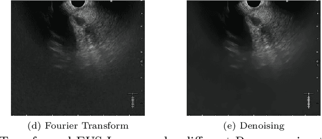Figure 2 for Automatic Endoscopic Ultrasound Station Recognition with Limited Data