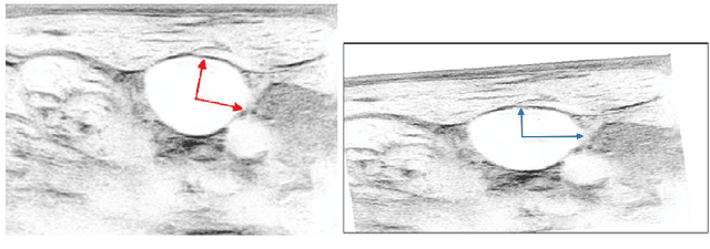 Figure 3 for Impact of PCA-based preprocessing and different CNN structures on deformable registration of sonograms