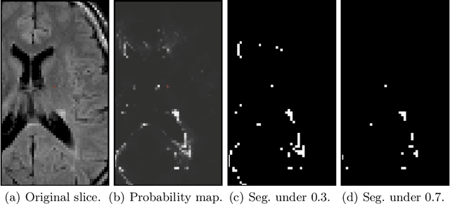 Figure 1 for P-Count: Persistence-based Counting of White Matter Hyperintensities in Brain MRI