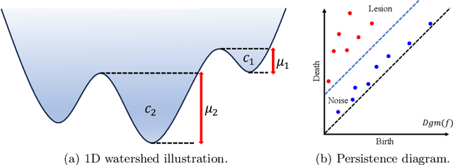 Figure 3 for P-Count: Persistence-based Counting of White Matter Hyperintensities in Brain MRI