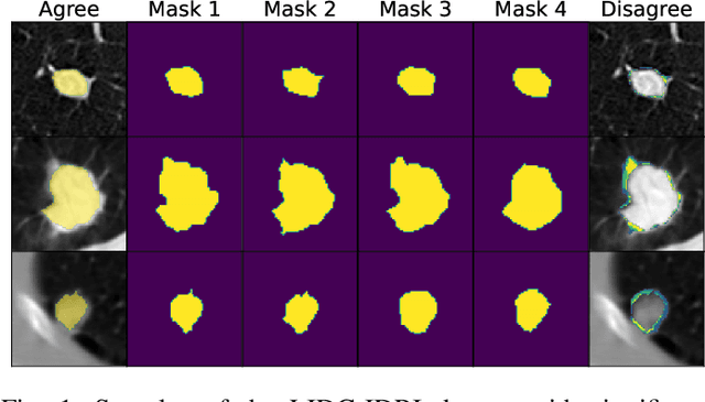 Figure 1 for Investigating and Improving Latent Density Segmentation Models for Aleatoric Uncertainty Quantification in Medical Imaging