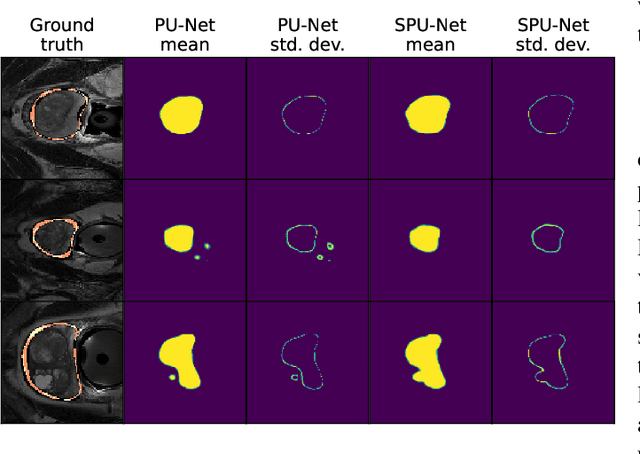 Figure 2 for Investigating and Improving Latent Density Segmentation Models for Aleatoric Uncertainty Quantification in Medical Imaging