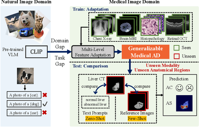 Figure 1 for Adapting Visual-Language Models for Generalizable Anomaly Detection in Medical Images