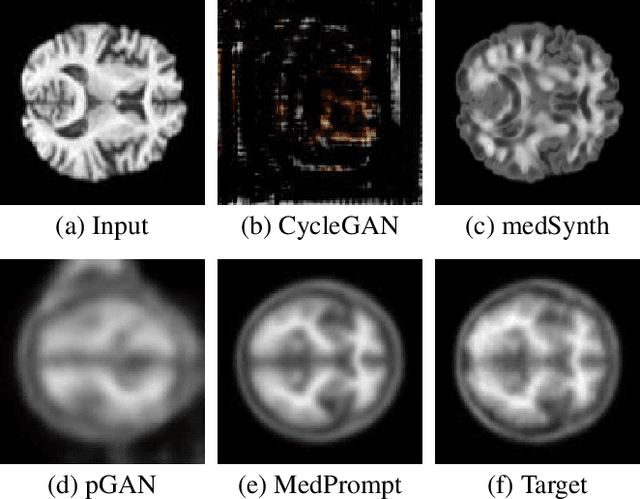 Figure 1 for MedPrompt: Cross-Modal Prompting for Multi-Task Medical Image Translation