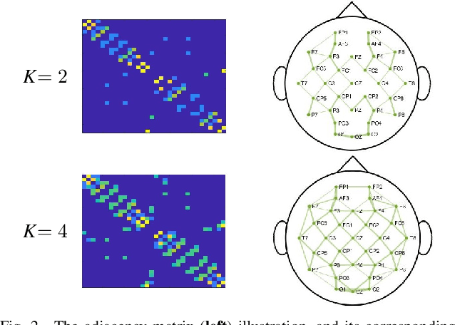 Figure 2 for A Hybrid End-to-End Spatio-Temporal Attention Neural Network with Graph-Smooth Signals for EEG Emotion Recognition