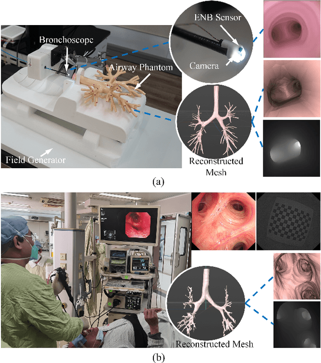 Figure 1 for DD-VNB: A Depth-based Dual-Loop Framework for Real-time Visually Navigated Bronchoscopy