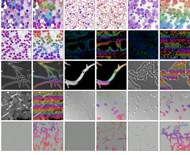 Figure 1 for MEDIAR: Harmony of Data-Centric and Model-Centric for Multi-Modality Microscopy