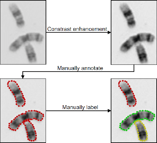 Figure 4 for AutoKary2022: A Large-Scale Densely Annotated Dateset for Chromosome Instance Segmentation