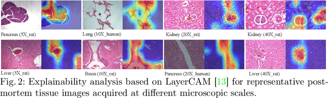 Figure 4 for Forensic Histopathological Recognition via a Context-Aware MIL Network Powered by Self-Supervised Contrastive Learning