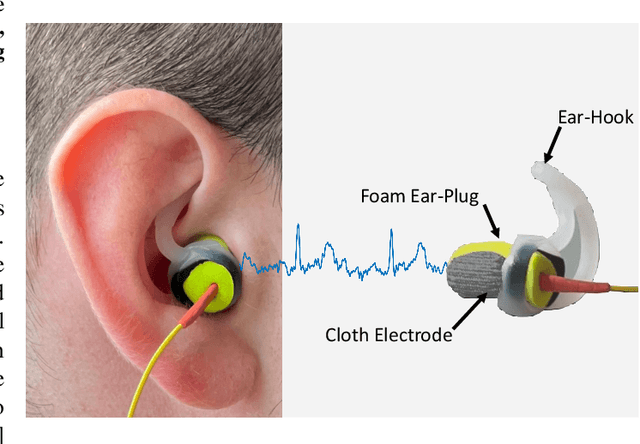 Figure 1 for A Deep Matched Filter For R-Peak Detection in Ear-ECG