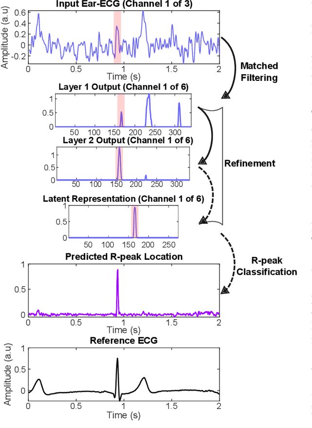 Figure 3 for A Deep Matched Filter For R-Peak Detection in Ear-ECG