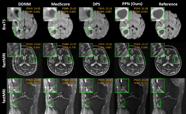 Figure 3 for Fast Controllable Diffusion Models for Undersampled MRI Reconstruction