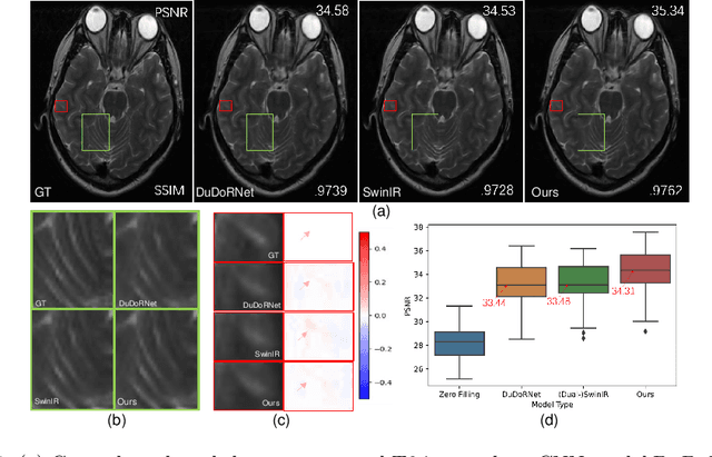 Figure 1 for DuDoRNeXt: A hybrid model for dual-domain undersampled MRI reconstruction