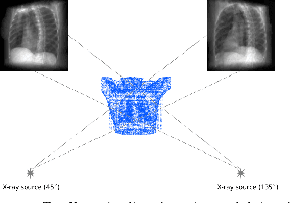 Figure 1 for XTransCT: Ultra-Fast Volumetric CT Reconstruction using Two Orthogonal X-Ray Projections via a Transformer Network