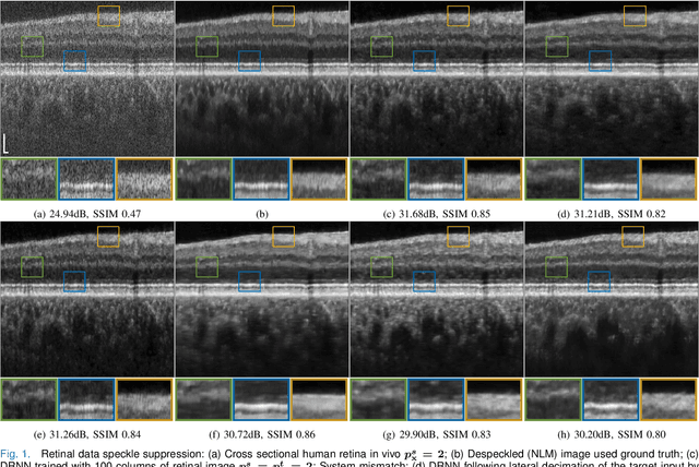 Figure 1 for Domain-Aware Few-Shot Learning for Optical Coherence Tomography Noise Reduction