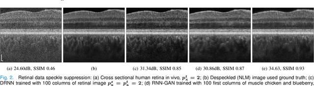 Figure 2 for Domain-Aware Few-Shot Learning for Optical Coherence Tomography Noise Reduction