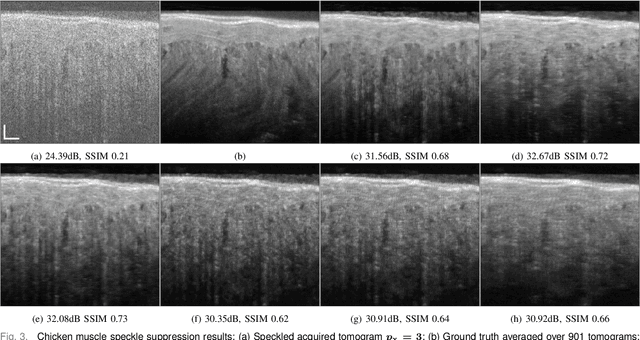 Figure 3 for Domain-Aware Few-Shot Learning for Optical Coherence Tomography Noise Reduction