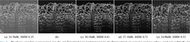 Figure 4 for Domain-Aware Few-Shot Learning for Optical Coherence Tomography Noise Reduction