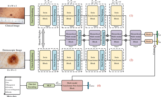 Figure 3 for TFormer: A throughout fusion transformer for multi-modal skin lesion diagnosis