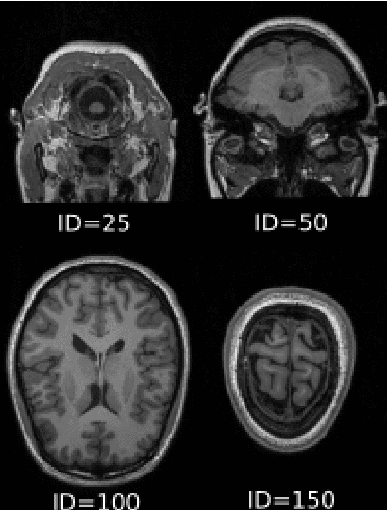 Figure 3 for A Survey of Feature detection methods for localisation of plain sections of Axial Brain Magnetic Resonance Imaging