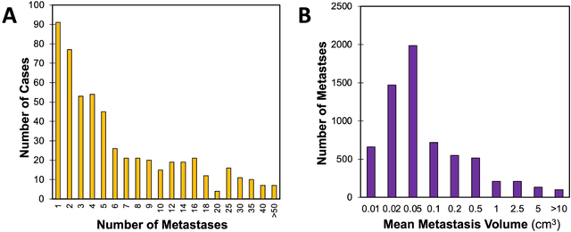 Figure 2 for The University of California San Francisco, Brain Metastases Stereotactic Radiosurgery (UCSF-BMSR) MRI Dataset