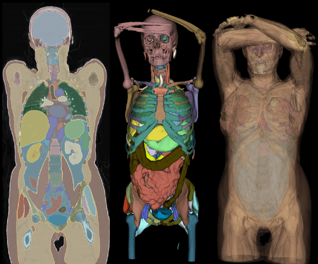 Figure 1 for Towards Unifying Anatomy Segmentation: Automated Generation of a Full-body CT Dataset via Knowledge Aggregation and Anatomical Guidelines