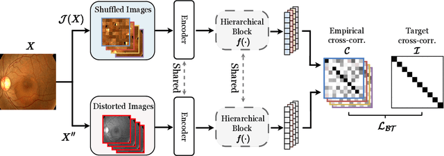 Figure 1 for Fine-Grained Self-Supervised Learning with Jigsaw Puzzles for Medical Image Classification