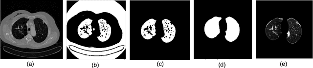 Figure 1 for MEDS-Net: Self-Distilled Multi-Encoders Network with Bi-Direction Maximum Intensity projections for Lung Nodule Detection