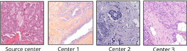 Figure 1 for Standardized CycleGAN training for unsupervised stain adaptation in invasive carcinoma classification for breast histopathology