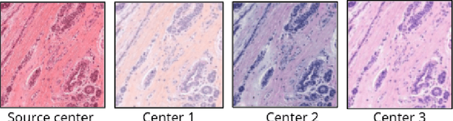 Figure 3 for Standardized CycleGAN training for unsupervised stain adaptation in invasive carcinoma classification for breast histopathology