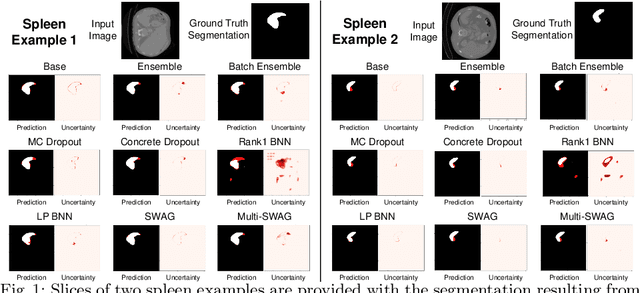 Figure 1 for Benchmarking Scalable Epistemic Uncertainty Quantification in Organ Segmentation