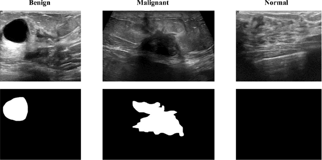 Figure 1 for BreastSAM: A Study of Segment Anything Model for Breast Tumor Detection in Ultrasound Images