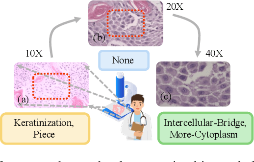Figure 1 for Data and Knowledge Co-driving for Cancer Subtype Classification on Multi-Scale Histopathological Slides