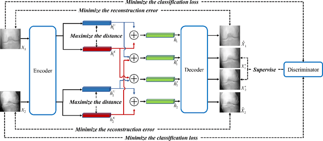 Figure 1 for Key-Exchange Convolutional Auto-Encoder for Data Augmentation in Early Knee OsteoArthritis Classification