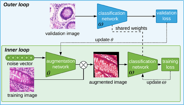 Figure 1 for Automatic Data Augmentation Learning using Bilevel Optimization for Histopathological Images