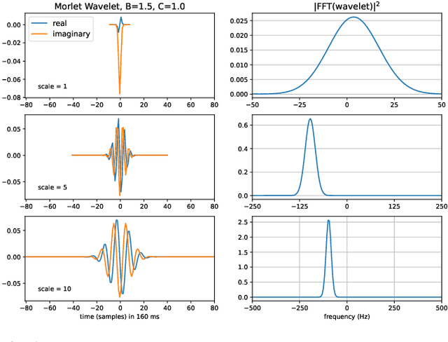 Figure 1 for EEG-NeXt: A Modernized ConvNet for The Classification of Cognitive Activity from EEG