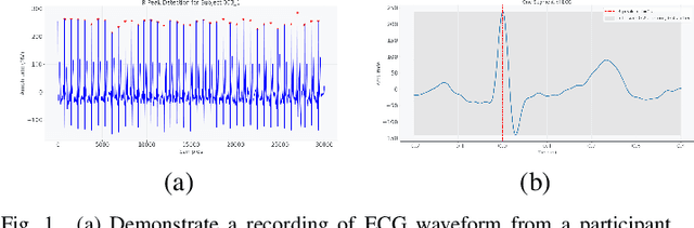 Figure 1 for Advancements in Continuous Glucose Monitoring: Integrating Deep Learning and ECG Signal