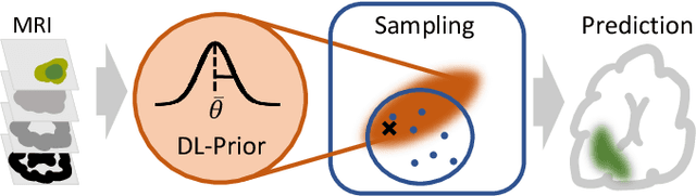 Figure 1 for A Learnable Prior Improves Inverse Tumor Growth Modeling