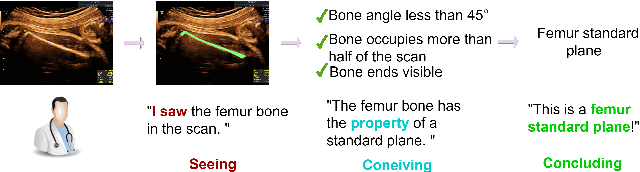 Figure 1 for I saw, I conceived, I concluded: Progressive Concepts as Bottlenecks