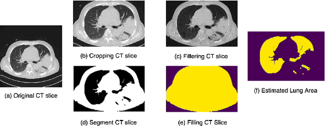 Figure 1 for Strong Baseline and Bag of Tricks for COVID-19 Detection of CT Scans