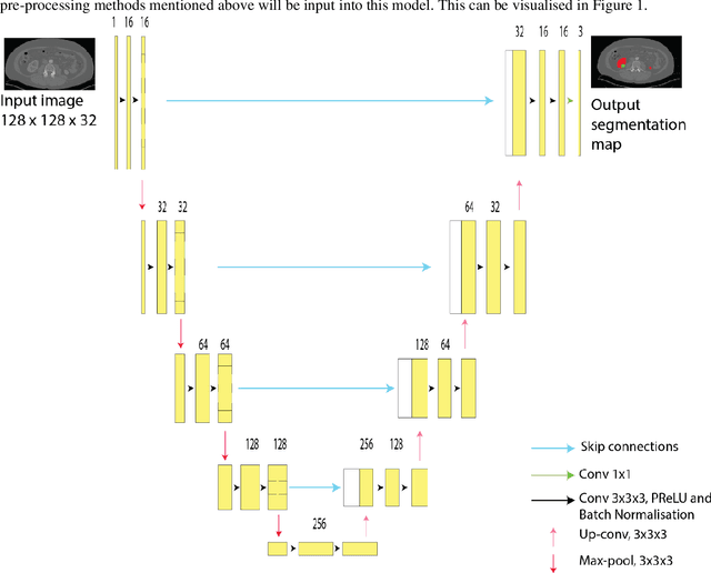 Figure 1 for Kidney and Kidney Tumour Segmentation in CT Images