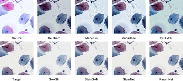 Figure 3 for ParamNet: A Parameter-variable Network for Fast Stain Normalization