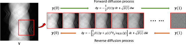 Figure 1 for Patch-Based Denoising Diffusion Probabilistic Model for Sparse-View CT Reconstruction
