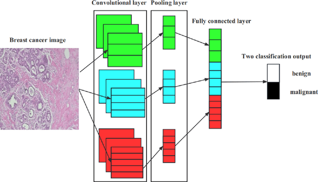 Figure 1 for Enhancing Breast Cancer Classification Using Transfer ResNet with Lightweight Attention Mechanism