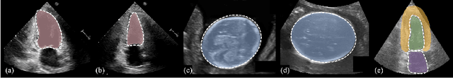 Figure 1 for FFPN: Fourier Feature Pyramid Network for Ultrasound Image Segmentation