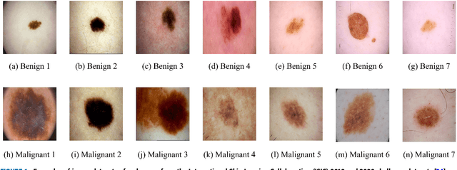 Figure 1 for Entropy-Aware Similarity for Balanced Clustering: A Case Study with Melanoma Detection